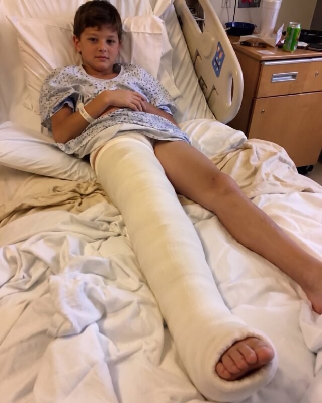 I Went to the Hospital to Care for My Son After He Broke His Leg – Then the Nurse Slipped Me a Note, ‘He’s Lying. Check the Camera at 3 a.m.’